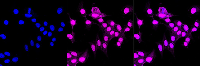 CRMP1 Antibody in Immunocytochemistry (ICC/IF)