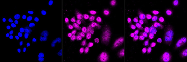 KGF Antibody in Immunocytochemistry (ICC/IF)