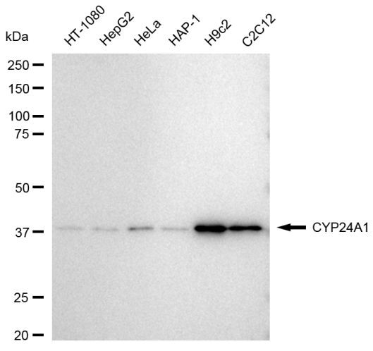 CYP24A1 Antibody in Western Blot (WB)