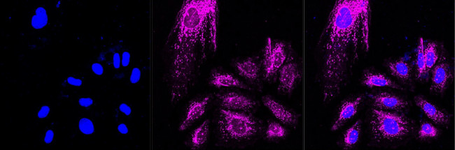 ADAM10 Antibody in Immunocytochemistry (ICC/IF)