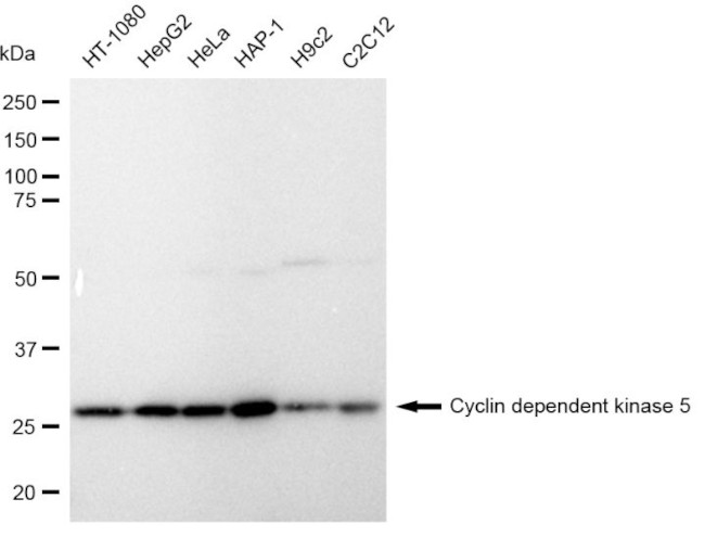 CDK5 Antibody in Western Blot (WB)