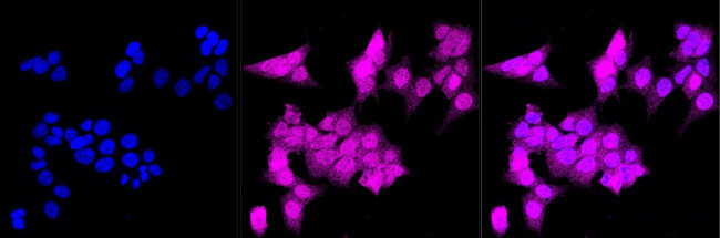 4EBP1 Antibody in Immunocytochemistry (ICC/IF)