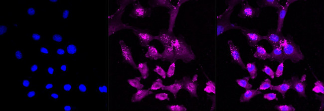 STUB1 Antibody in Immunocytochemistry (ICC/IF)