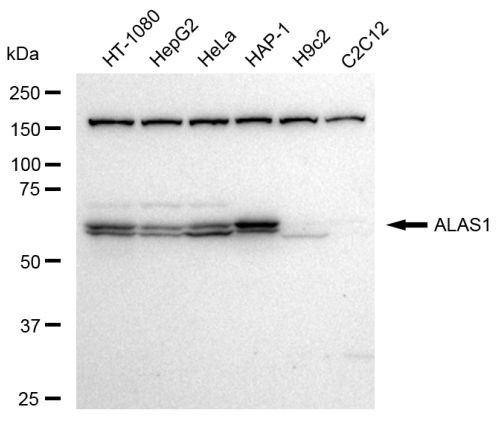 ALAS1 Antibody in Western Blot (WB)