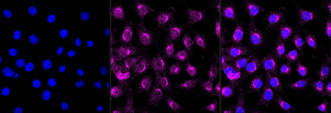 ARF1 Antibody in Immunocytochemistry (ICC/IF)