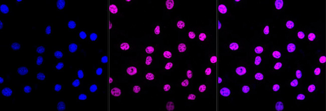 ARID1A Antibody in Immunocytochemistry (ICC/IF)