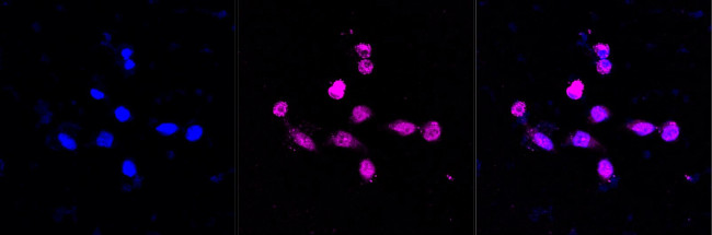 RAD50 Antibody in Immunocytochemistry (ICC/IF)