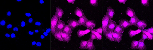 PKC delta/theta Antibody in Immunocytochemistry (ICC/IF)