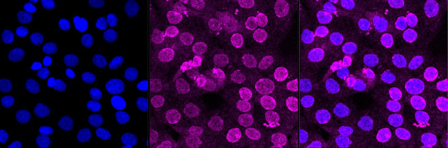 CSK Antibody in Immunocytochemistry (ICC/IF)