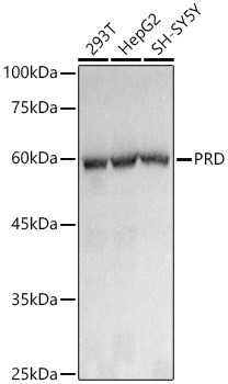 PEPD Antibody in Western Blot (WB)