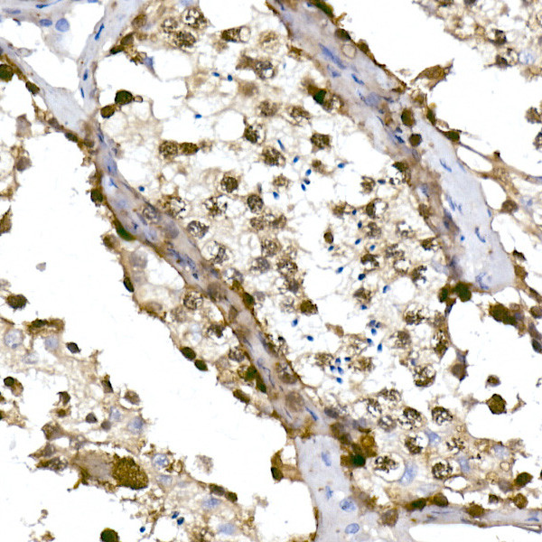 TET1 Antibody in Immunohistochemistry (Paraffin) (IHC (P))