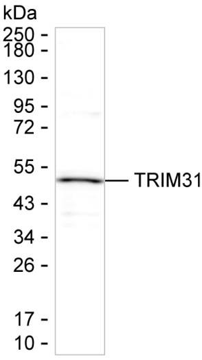 TRIM31 Antibody in Western Blot (WB)