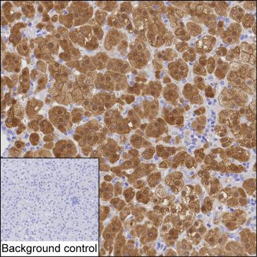 AKR1B1 Antibody in Immunohistochemistry (Paraffin) (IHC (P))