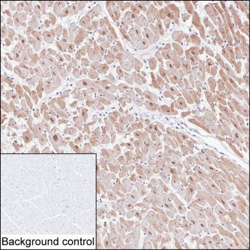 CaMKII delta Antibody in Immunohistochemistry (Paraffin) (IHC (P))