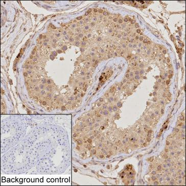 TRIM17 Antibody in Immunohistochemistry (Paraffin) (IHC (P))