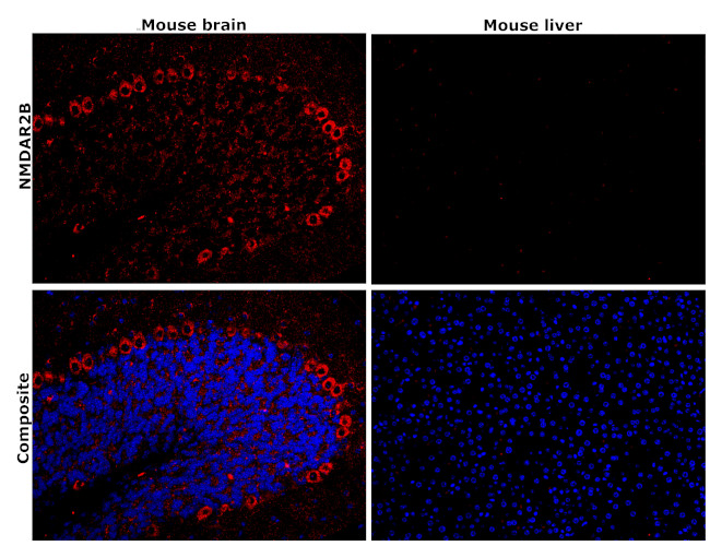 NMDAR2B Antibody in Immunohistochemistry (Paraffin) (IHC (P))