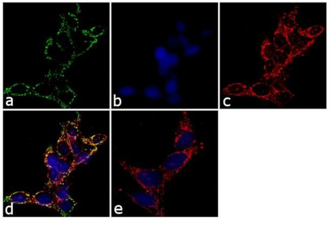 Prostate Specific Acid Phosphatase Antibody in Immunocytochemistry (ICC/IF)