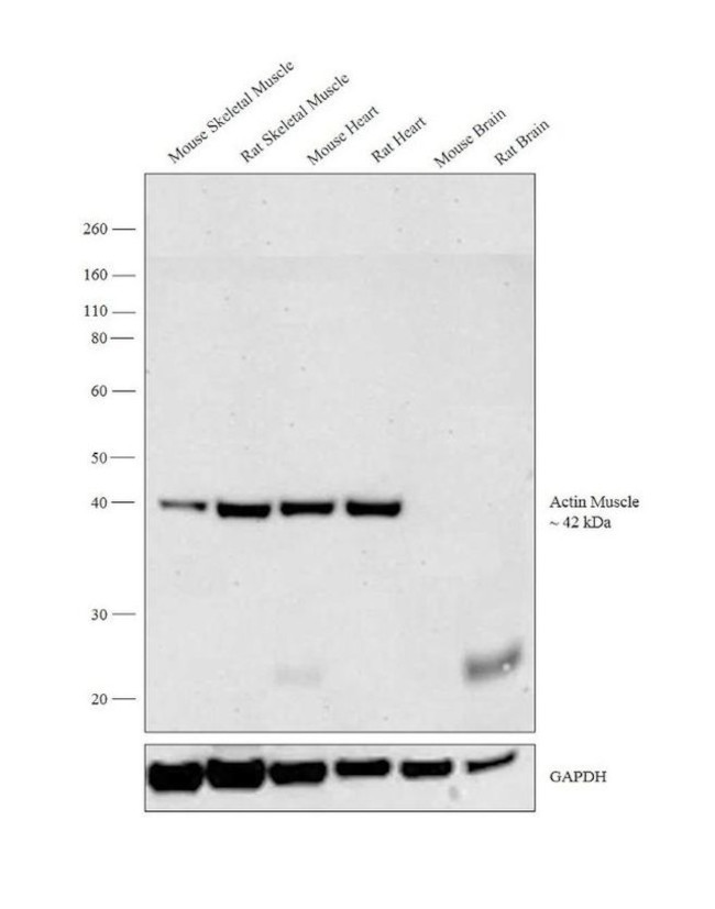 Actin Muscle Antibody