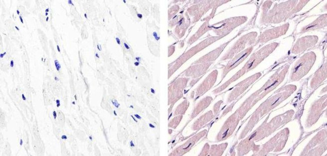 c-Abl Antibody in Immunohistochemistry (Paraffin) (IHC (P))