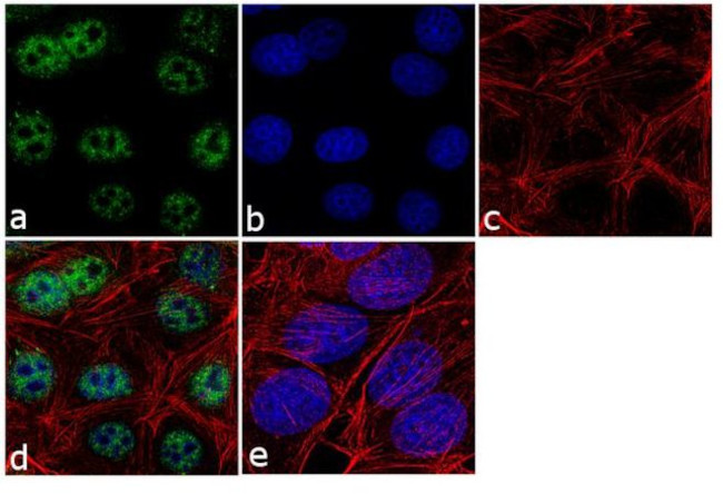 VDR Antibody in Immunocytochemistry (ICC/IF)