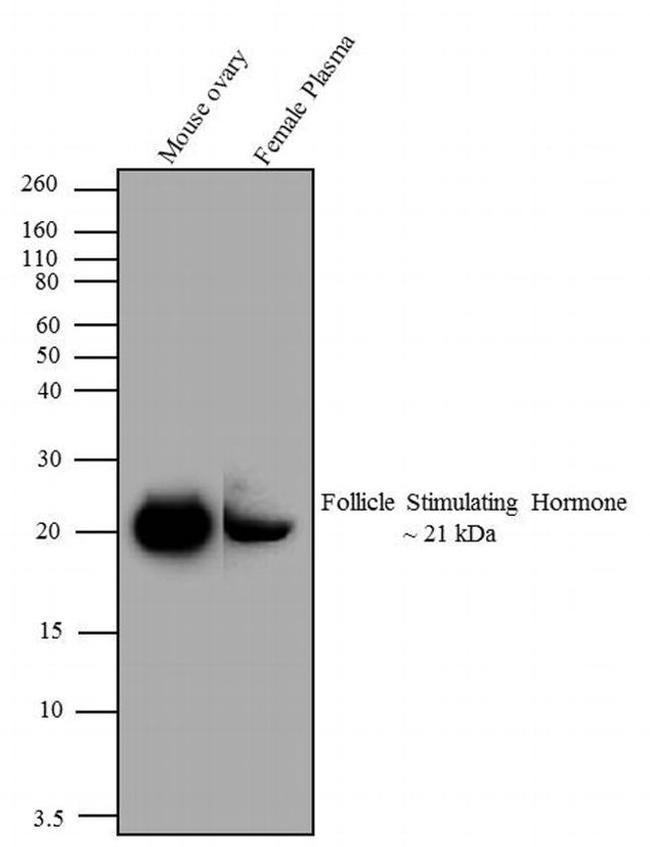 Follicle Stimulating Hormone Antibody in Western Blot (WB)