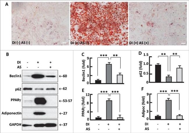 PPAR gamma Antibody in Western Blot (WB)