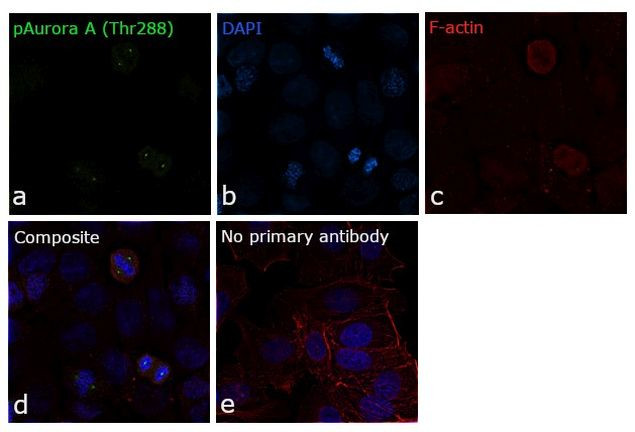 Phospho-Aurora A (Thr288) Monoclonal Antibody (F.131.2) (MA5-14904)