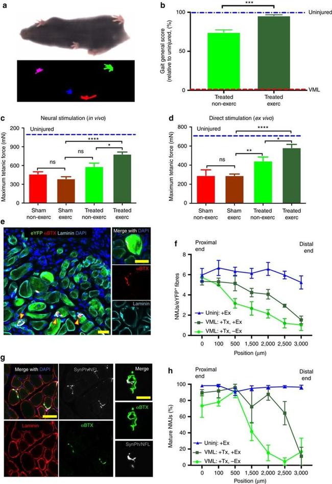 NEFL Antibody in Immunocytochemistry (ICC/IF)