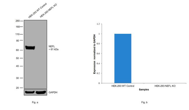 NEFL Antibody in Western Blot (WB)