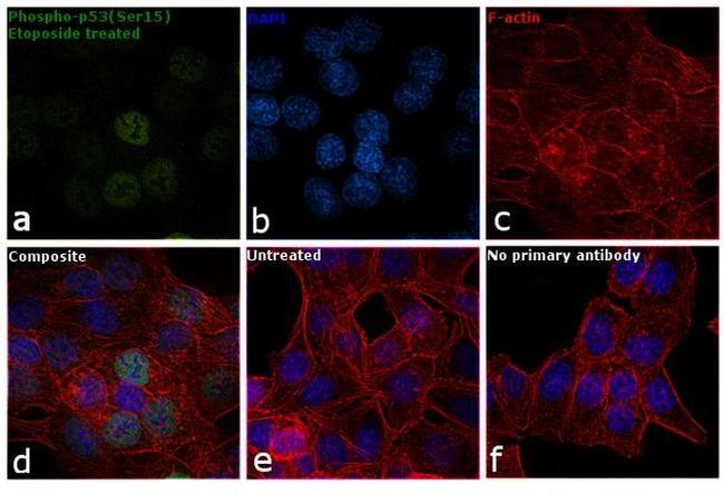 Phospho-p53 (Ser15) Antibody