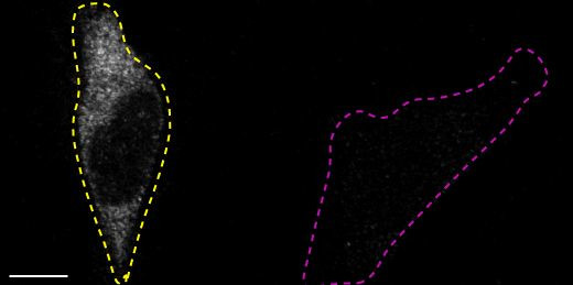 Dynamin 1 Antibody in Immunocytochemistry (ICC/IF)