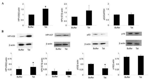 HPV Type 16 E7 Antibody in Western Blot (WB)