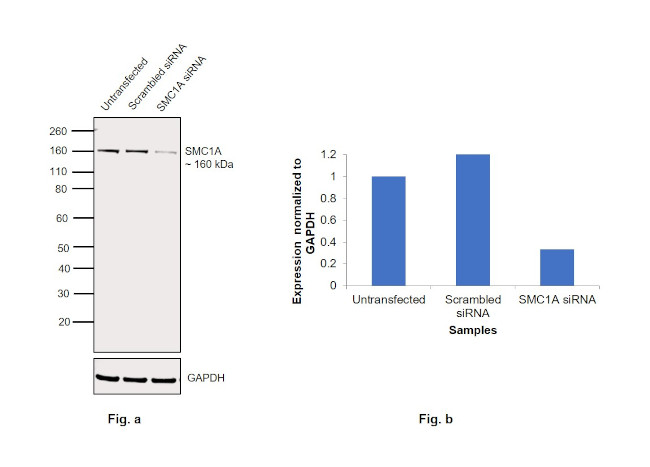 SMC1 Antibody