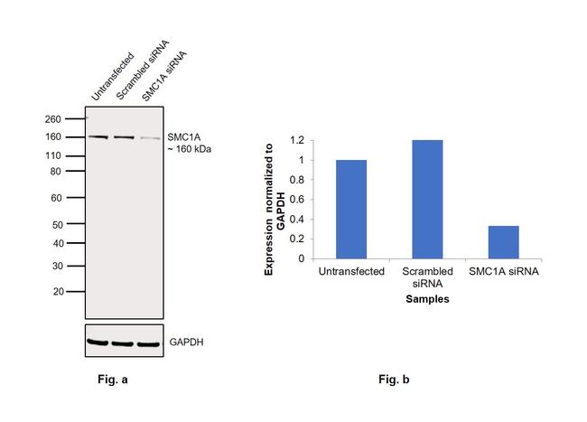 SMC1 Antibody in Western Blot (WB)