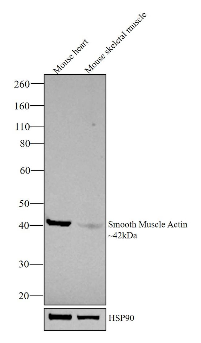 Alpha-Smooth Muscle Actin Antibody in Western Blot (WB)