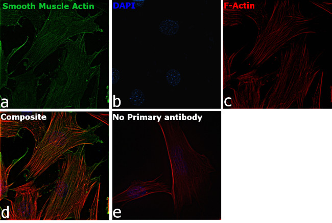 Alpha-Smooth Muscle Actin Antibody in Immunocytochemistry (ICC/IF)