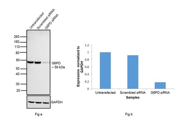 G6PD Antibody in Western Blot (WB)