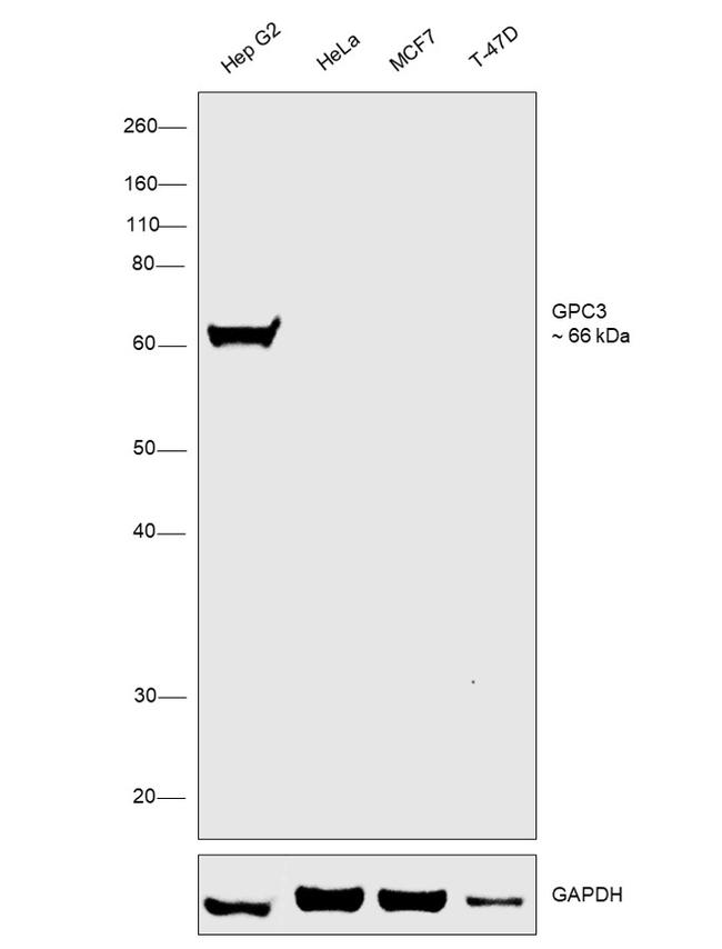 Glypican 3 Monoclonal Antibody (SP86) (MA5-16368)