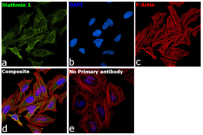 Stathmin 1 Antibody in Immunocytochemistry (ICC/IF)