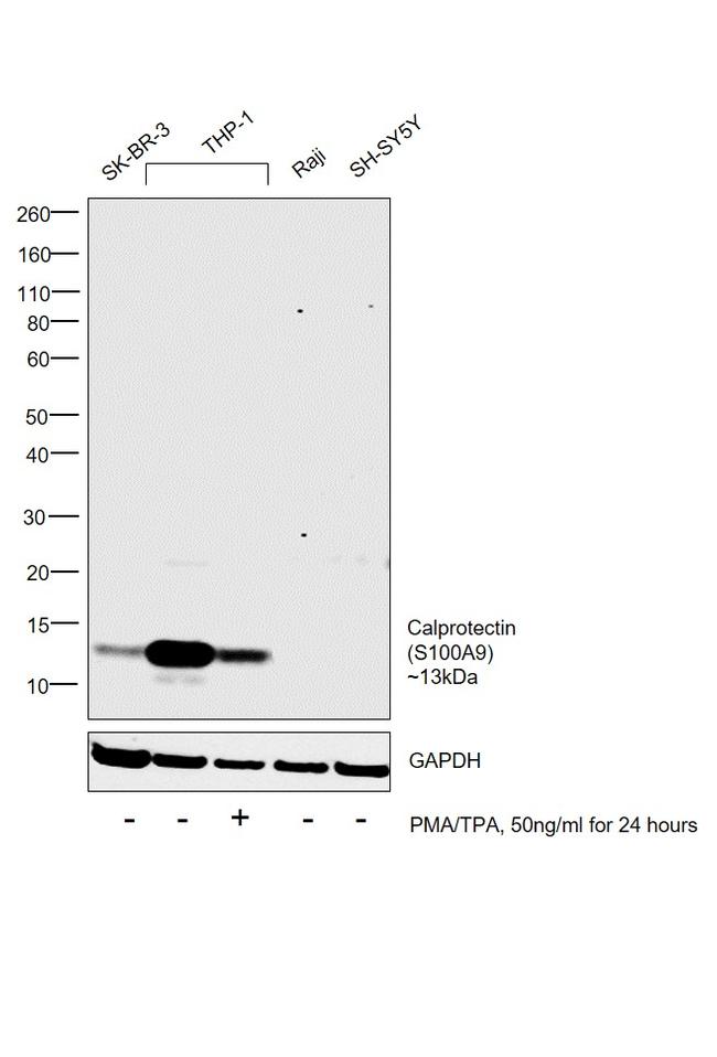 Calprotectin Antibody in Western Blot (WB)