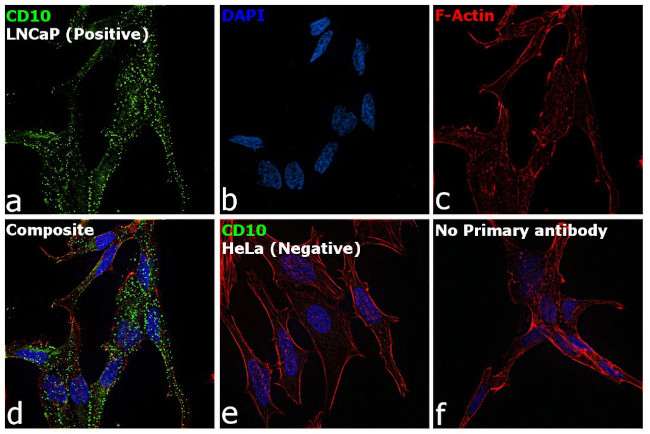 CD10 Antibody in Immunocytochemistry (ICC/IF)