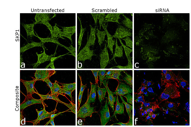 SKP1 Antibody