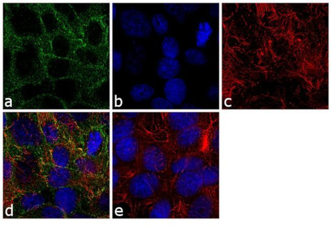 NOTCH2 Antibody in Immunocytochemistry (ICC/IF)