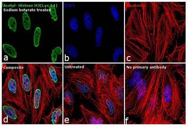 H3K14ac Antibody in Immunocytochemistry (ICC/IF)