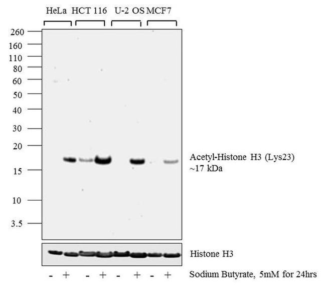 H3K23ac Antibody in Western Blot (WB)