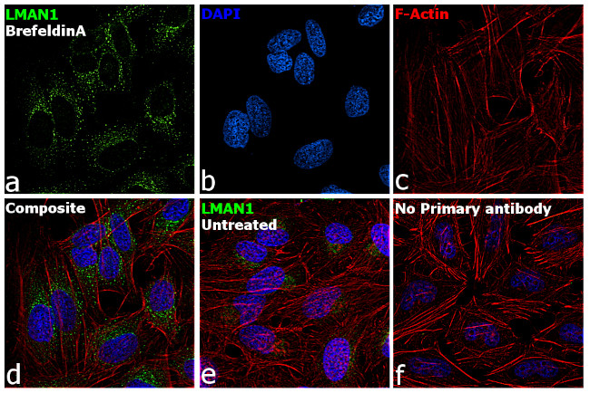 LMAN1 Antibody in Immunocytochemistry (ICC/IF)