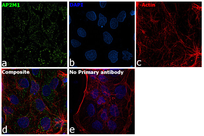 AP2M1 Antibody in Immunocytochemistry (ICC/IF)