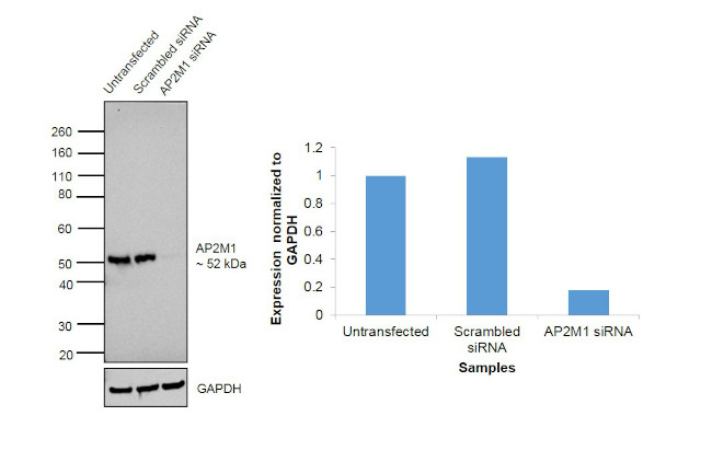 AP2M1 Antibody