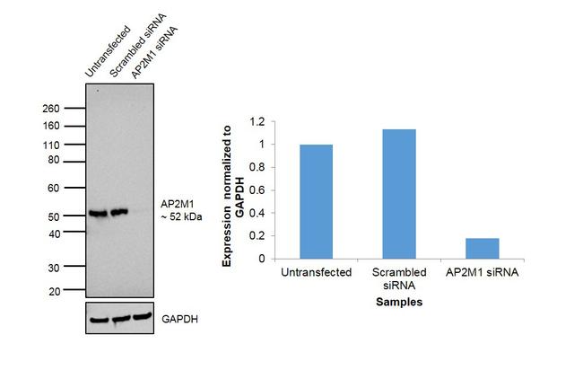 AP2M1 Antibody in Western Blot (WB)