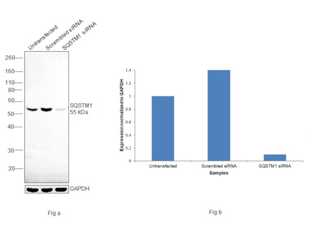 SQSTM1 Antibody